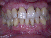 10 Terapia non chirurgica l