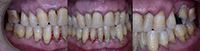 10 Terapia non chirurgica r