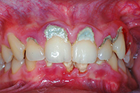 3a