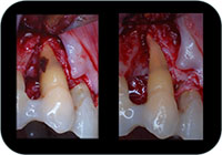12 terapia chirurgica