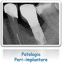 Patologia peri-implantare